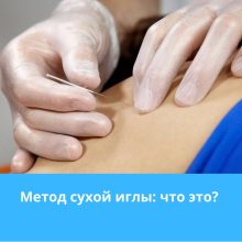 Метод сухой иглы